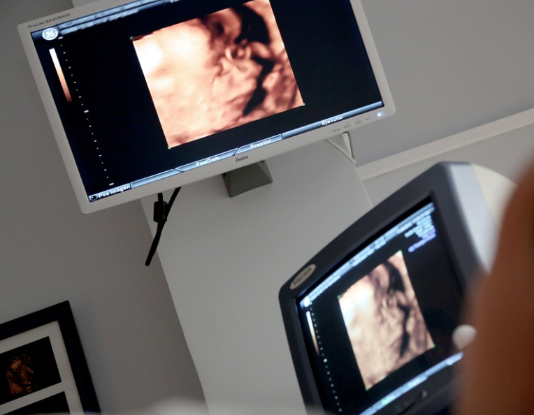 US House Passes Born-Alive Abortion Survivors Protection Act